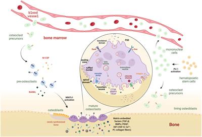 The Osteoclast Traces the Route to Bone Tumors and Metastases